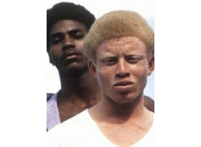 albino africa